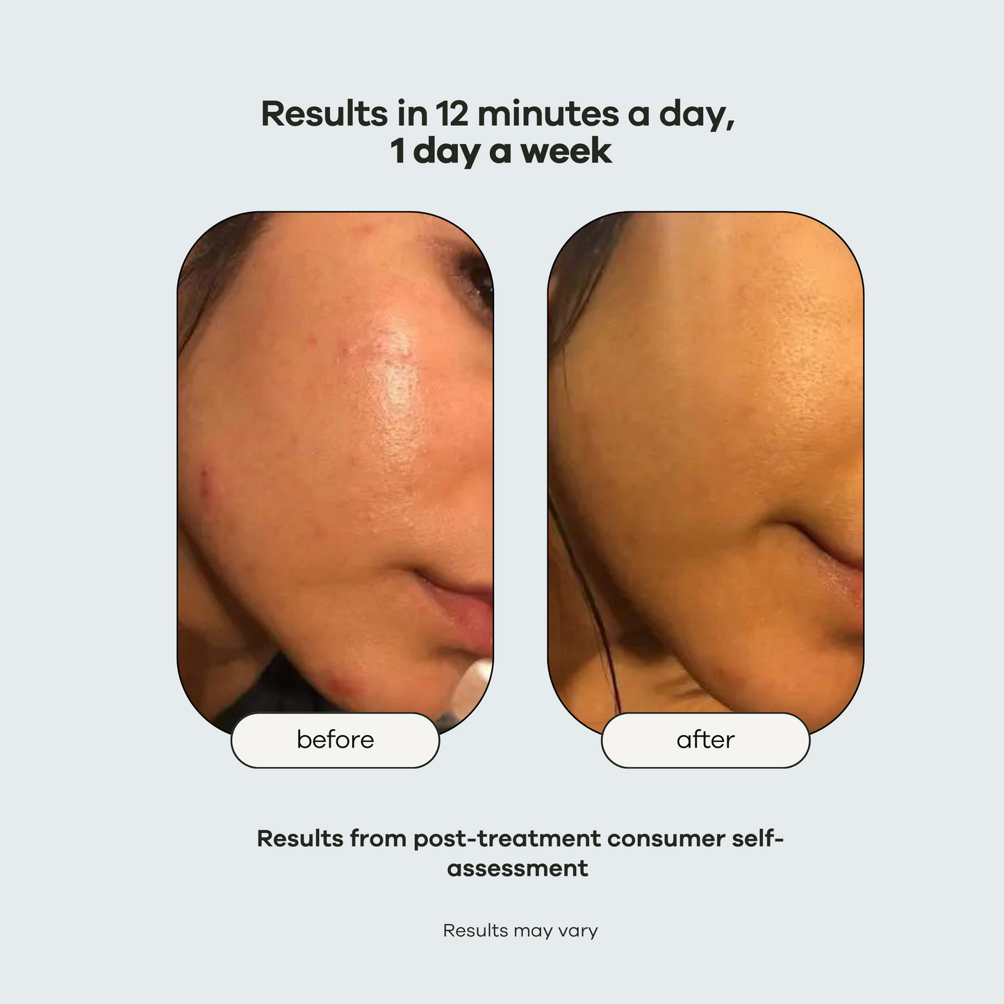 Copy of Pore Cleanse: Hydration Handset