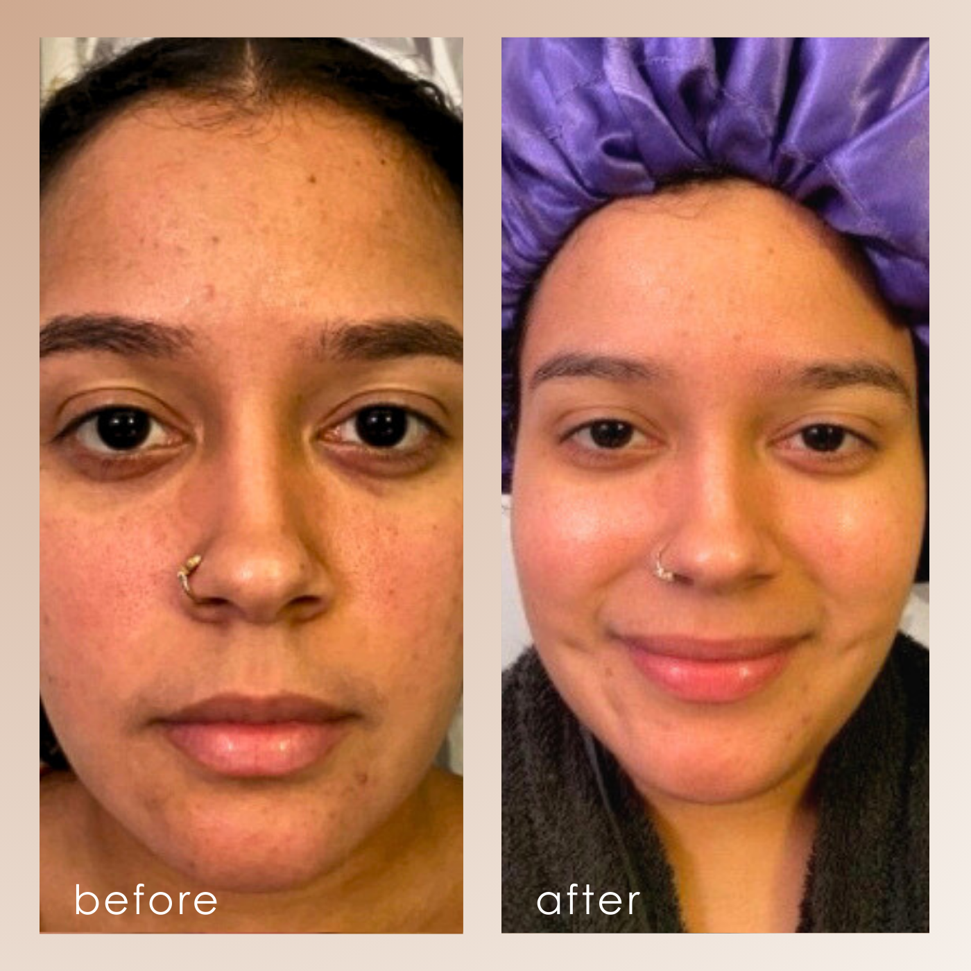 Sensa | Nano Ionic Facial Steamer