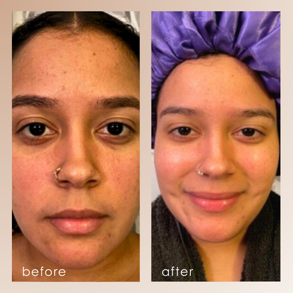 Sensa | Nano Ionic Facial Steamer